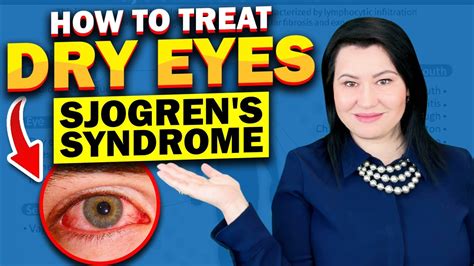 sjogren's syndrome tear test filter|sjogren's syndrome treatment.